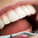 Basics of dental care