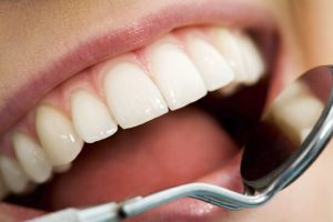 Basics of dental care