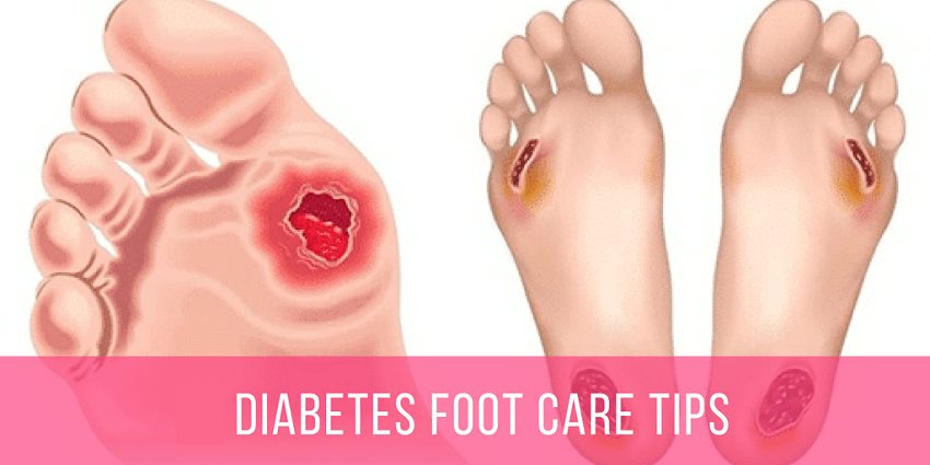 Diabetes foot care