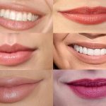 types of lips