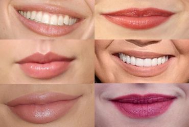 types of lips