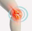 Latest Advancements in Knee Reconstruction