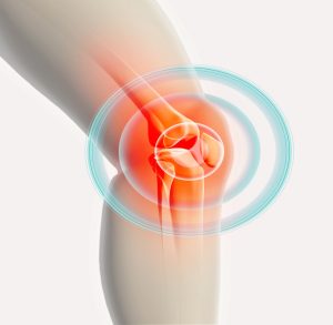 Latest Advancements in Knee Reconstruction